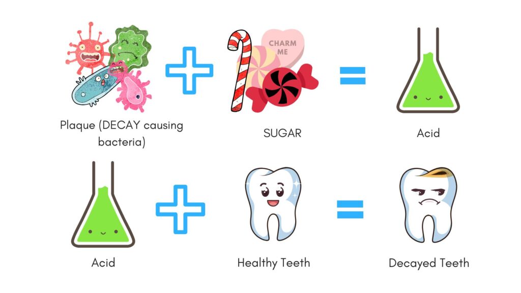 tooth decay caused by sugary foods